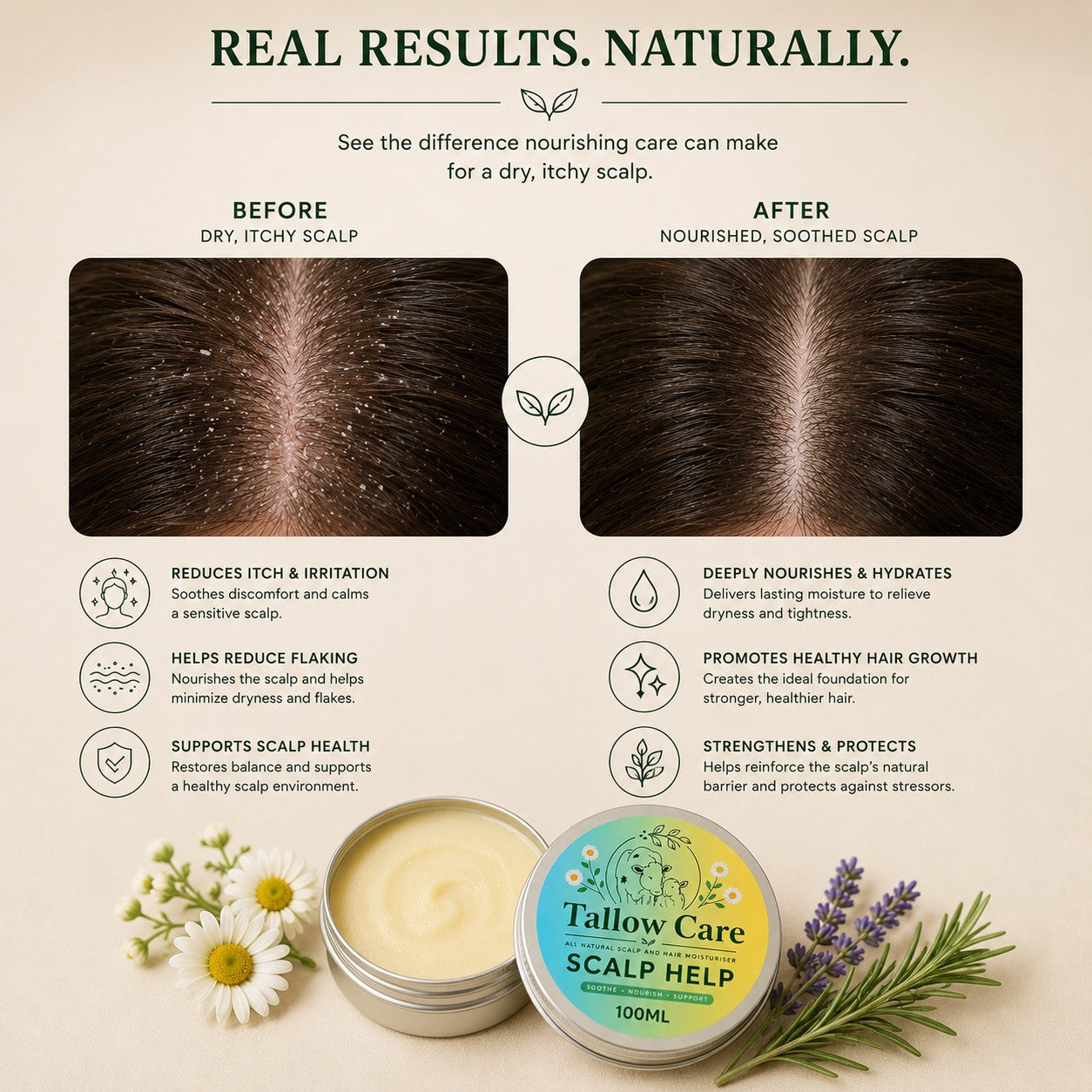 Scalp Help – Natural Care for a Healthy Scalp & Hair
